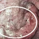 胃癌悄悄找上門！出現「這些警訊」已第三期　醫警告：3種食物少碰