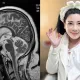 陳文茜秀「腦部MRI影像」曝病況　嘆：去年此時癌細胞激增！