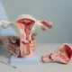 發生率暴增3倍！子宮內膜癌新療法納健保