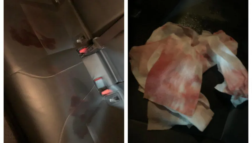 情侶搭小黃…後座神秘液體亂流！司機手抹「一片腥」曝真相　網嗆：胎戈渣某