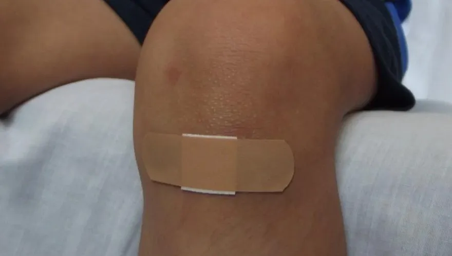 男童受傷感染「吃肉細菌」病逝！NHS警告：傷口出現10症狀馬上送醫