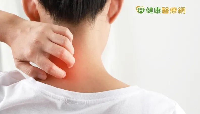 拚工作賠了健康！頸背發炎脫皮流血　連吞6顆類固醇都壓不住