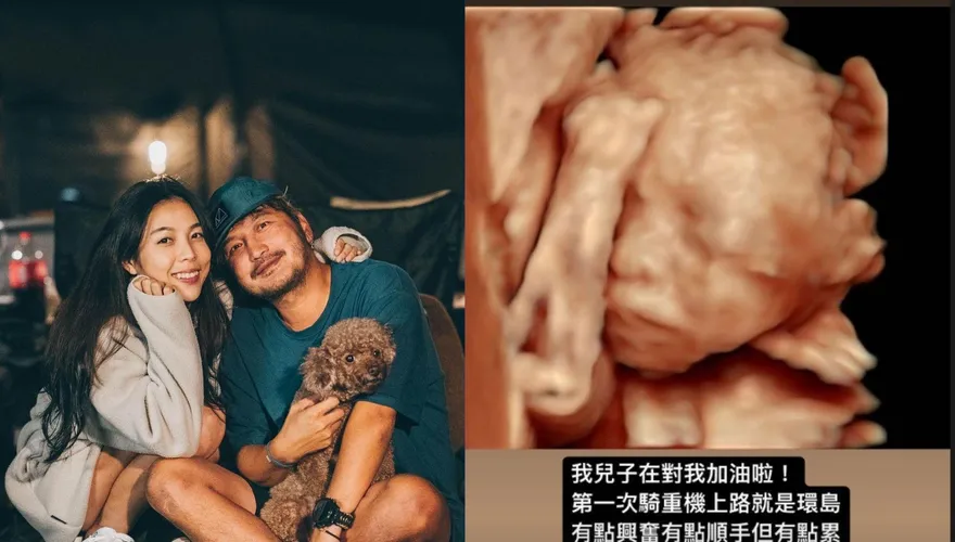KID幸福曬「寶寶超音波照」！他見「這動作」笑了：兒子在對我加油啦~