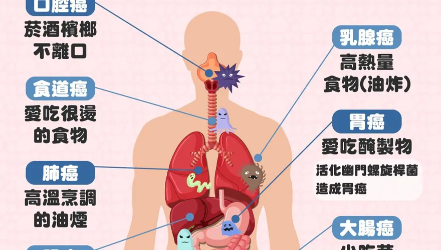 4/7世界健康日　癌症時鐘快轉每4:19有1人罹癌！注意4錯誤行為「5招大降癌症風險」