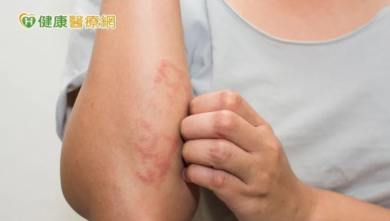 吃藥治痛風竟產生「致命副作用」！醫示警：死亡率超高　康復仍可能失明