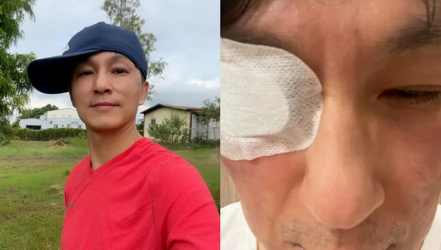 誤把「殺菌頭皮藥水」滴入眼！男星爆痛就醫「角膜慘遭灼傷」　驚悚傷勢照曝