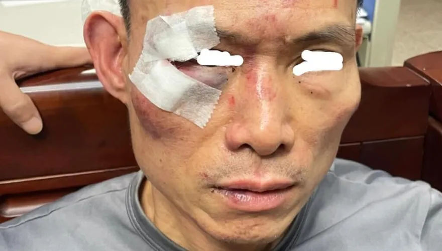 遭誤認通緝犯！警提10萬元和解金破局　三重挨揍男：要求汰除施暴惡警