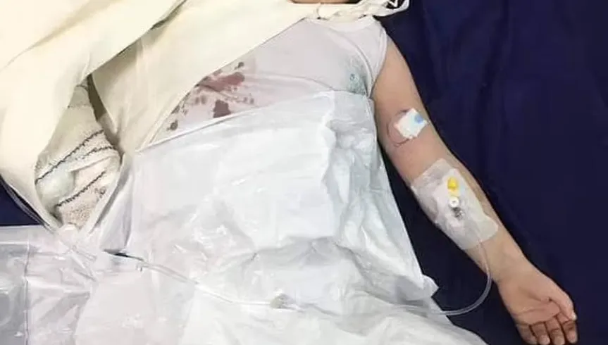 「手伸進圍欄」逗弄熊　3歲女童右手臂被熊咬斷！