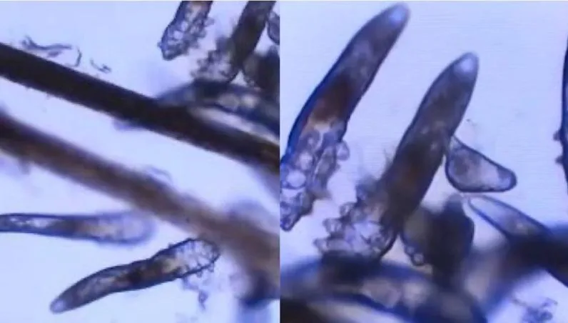驚！蟎蟲入侵母女眼　竟是寵物惹的禍