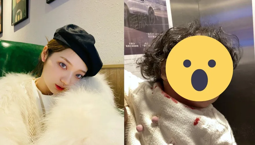 28歲女星家中慘遇爆破意外！1歲女頭部受創「血流滿臉」驚悚畫面曝　剛解封就奔醫院