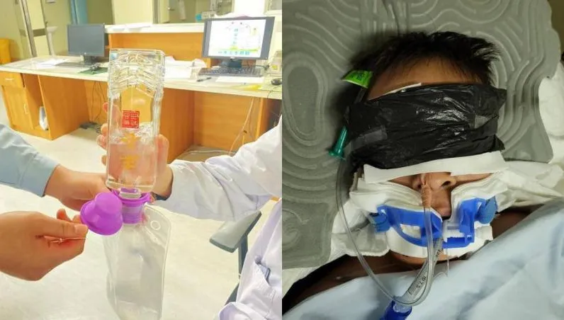 這招學起來！誤喝假酒命危…醫生用「真白酒」灌進他體內成功解毒