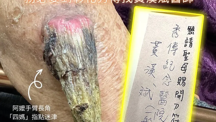 媽祖唯一指定！91歲嬤手臂長角　曝收「仙界轉診單」