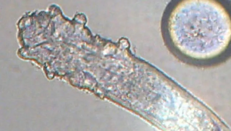 視力模糊又腫癢！她就醫驚見眼瞼「上百隻蟎蟲」亂爬　每根睫毛藏9隻