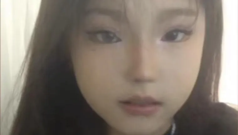 天生異瞳！18歲少女「右眼藍色」一度自卑　靠友轉變心境蛻變自信少女