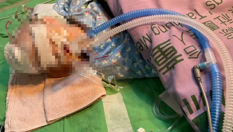 台中1歲女嬰「小桃子」疑遭虐腦傷　保母涉嫌重大遭收押