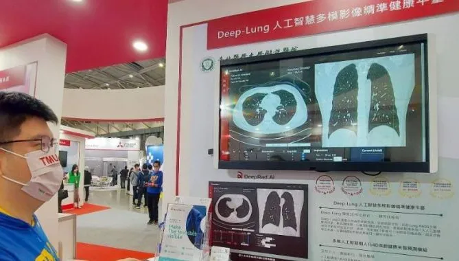 北醫大全球首創！一張電腦斷層預測「這四疾病」準確率達9成