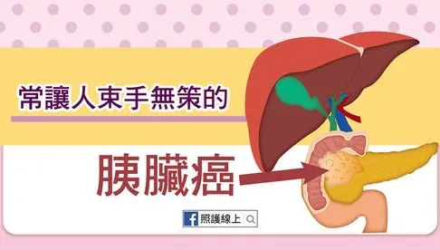 癌王胰臟癌新藥三期數據 杏國將登歐洲腫瘤學會