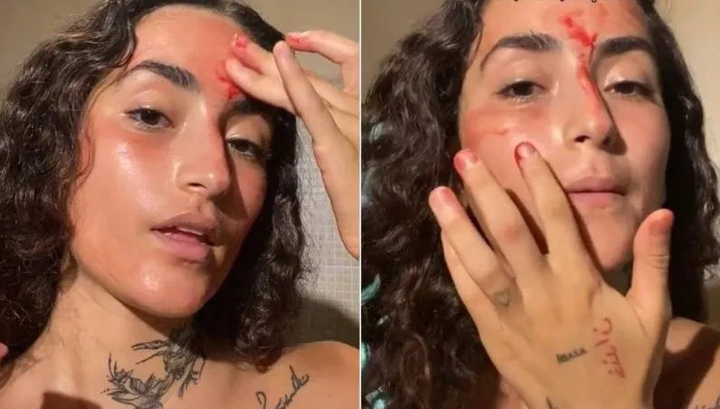 美女提倡「月經面膜」對身體有益　專家打臉警告「細菌很多！」