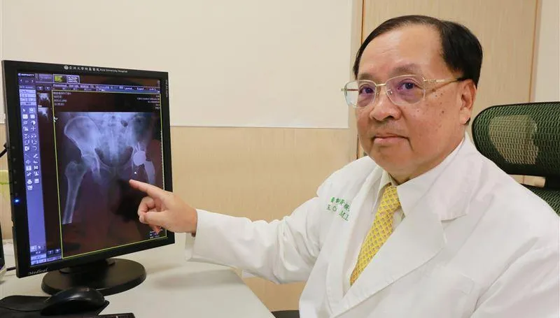5旬男爬山「腰超痛」竟是「喝酒」釀禍！就醫才知「髖骨蛀掉了」