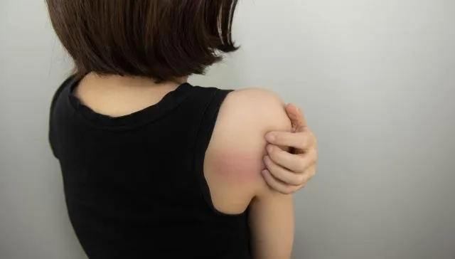 60歲婦抓到「全身都是傷」！醫曝：5人就有1人「慢性搔癢」