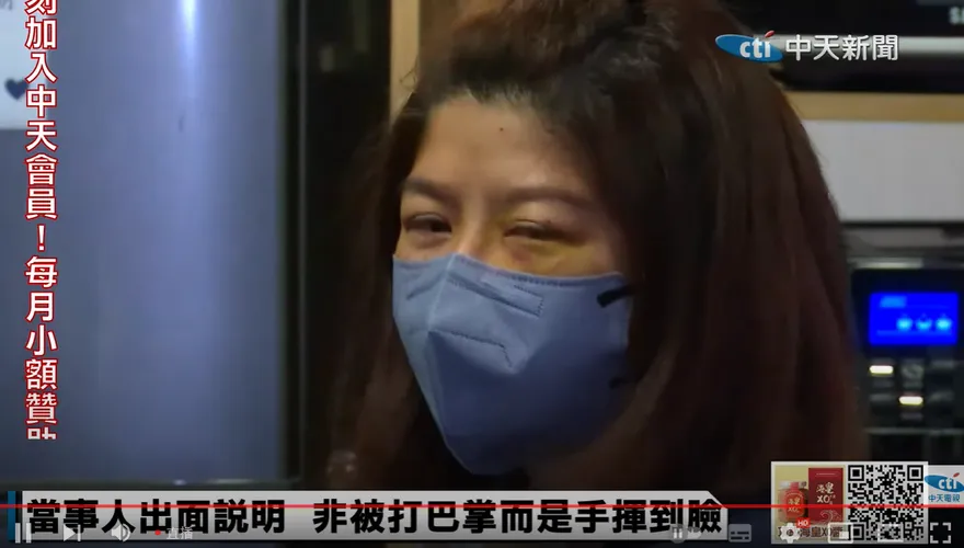 影/太玄宮執事自稱「被揮掉眼鏡」　臉上傷痕是被刮傷而非打傷