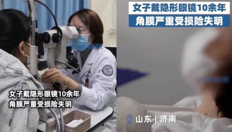 她戴隱眼10年出現「這症狀」！一檢查完了…視力剩0.1　眼角膜慘變灰白