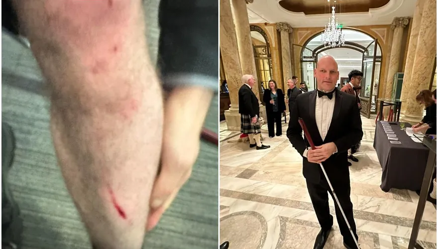 超猛！英國盲人記者下班遭搶　瞬間反擊制服歹徒還嗆：「你挑錯人了」