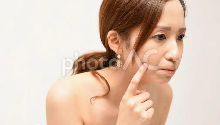青春不痘留　醫揭「四點」青春痘形成原因