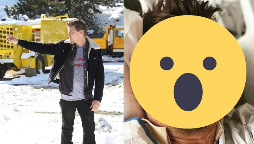 「鷹眼」遭鏟雪車碾過腿！親曝近況「30根骨頭斷了」　市長揭英勇受傷真相