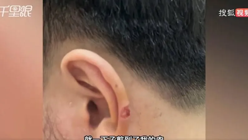 扯！年前剪髮竟遭「剪掉耳朵一塊肉」　店家只願賠900元嗆：又不影響生活！