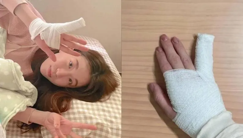 女網紅除夕玩心臟病急速一戳「小指歪了」送醫　本人揭傷勢：樂極生悲！