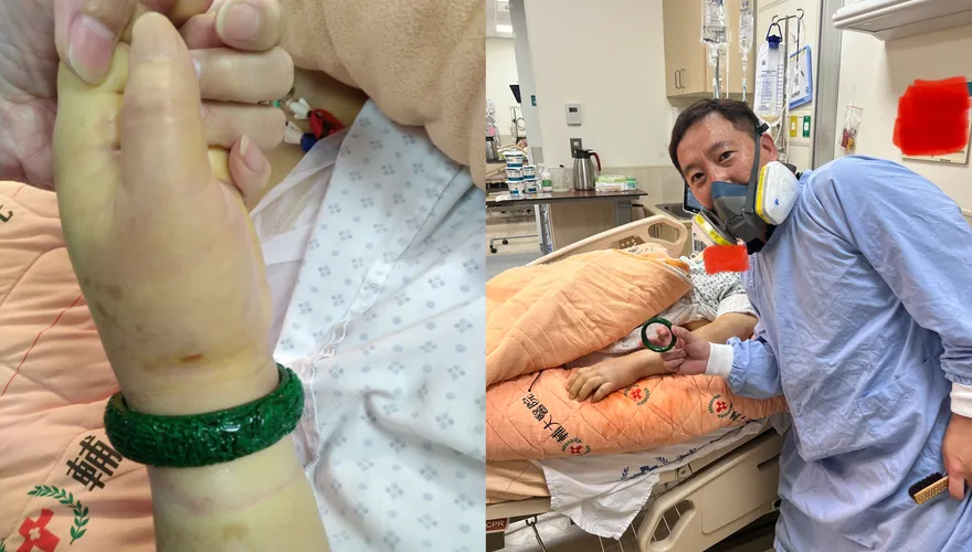百萬翡翠手鐲卡手腕！新北消防「脫戒達人」3法寶無損脫出