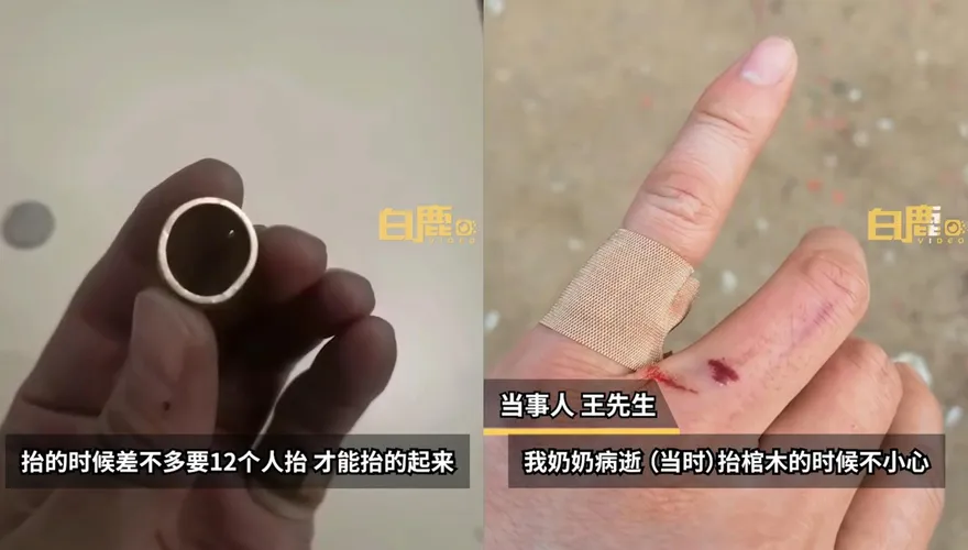 阿嬤保佑！千斤棺蓋突滑脫重壓...靠戴10年戒指保住手指