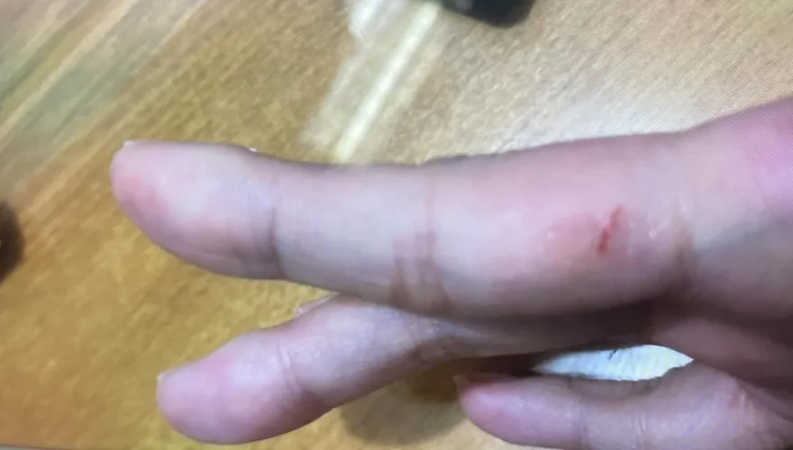 PPT爆女子搭捷運遭襲胸割手！警調影像未發現異常…研判真兇是它