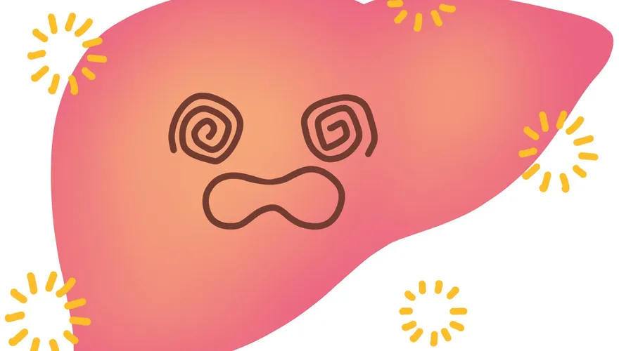 脂肪肝別輕忽！長庚研究：「脂肪肝恐罹慢性腎病、肝硬化」及時治療平均7成患者可痊癒