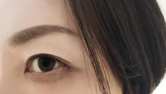 6旬婦眼睛被異物噴到找針灸治療！眼前突一片黑釀永久性傷害