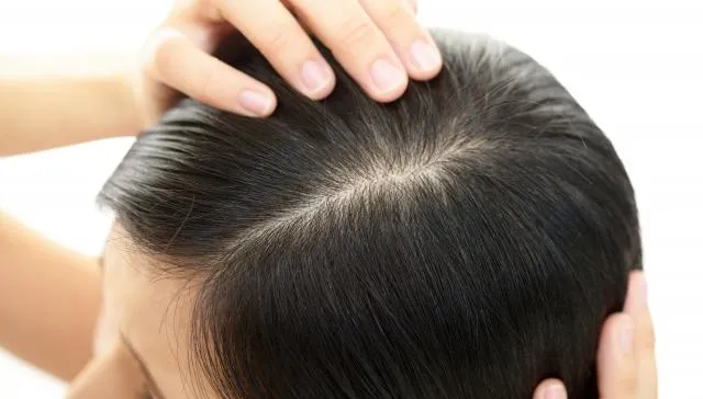 46歲女頭頂長痘1個月未癒　醫警：小心是癌細胞釀禍！