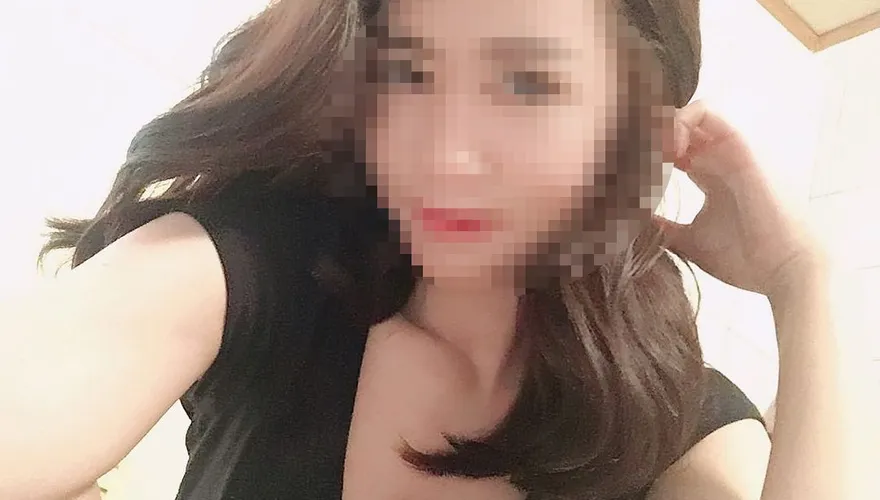 八大妹2度燙傷包紗布情緒轉穩定　網友憂心下半輩子恐全毀