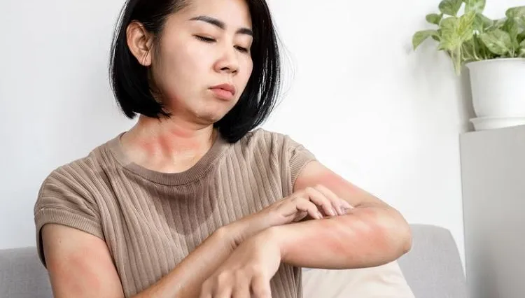 夏季防1蟲！一碰這蟲恐害皮膚潰爛、起水泡