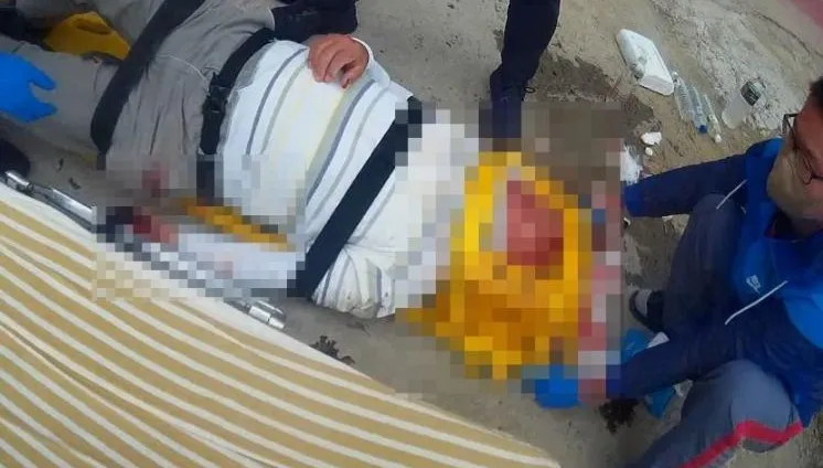 先撞擋風玻璃再噴飛人行道！「沒兩段式左轉」騎士挨撞滿臉血急救