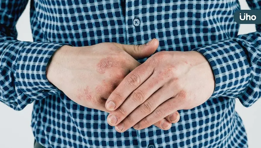 他皮膚長斑顆粒像癩蛤蟆「類澱粉沉積症」不只皮膚病！恐引爆7大疾病