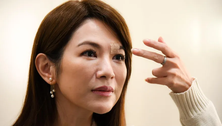 八點檔女星開拍前摔倒破相　「血狂流滴地」緊急送醫縫十多針...慘況曝光