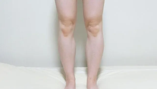 腿粗較健康！?醫：脂肪囤積在腹部　糖尿病、高血壓發生率高2倍