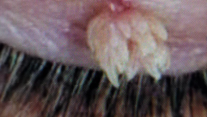 27歲男「眼皮上長肉瘤」眼科醫一看：是「菜花」右眼還冒粉色花椰菜