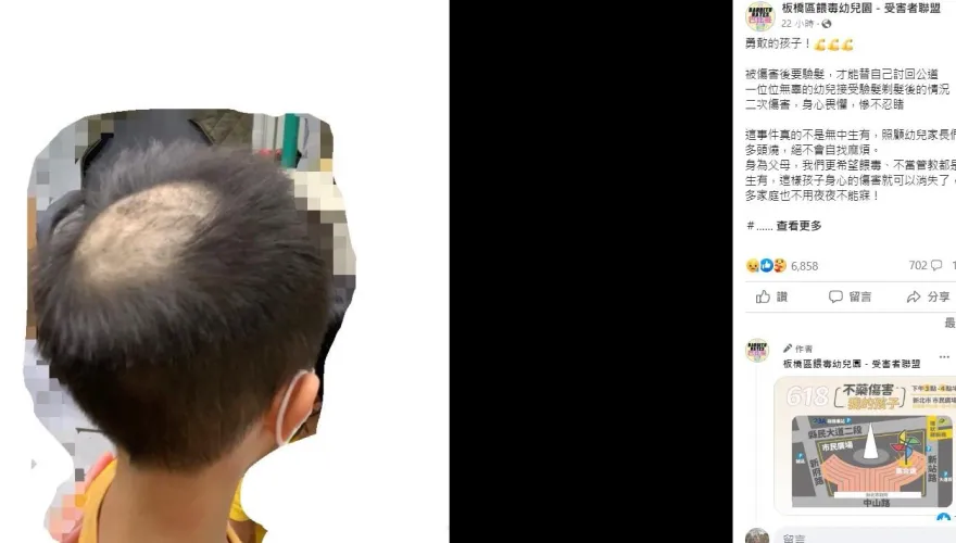 獨！採檢毛髮專家看到也嚇一跳!兒頭頂禿一塊惹怒家長 毛髮驗毒專家：通常只需剪0.2G-0.3G!