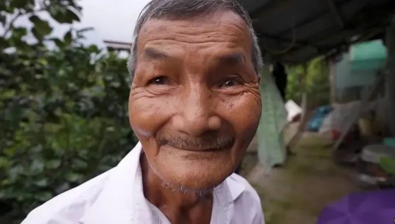 越戰時曾生重病反覆發燒　越南老翁自此失眠60年