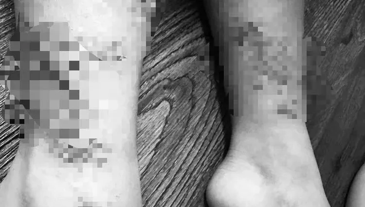 悚！男童到台南海邊戲水「雙腿慘遭割傷濺血」　母怒PO文：浮球繩子割人！