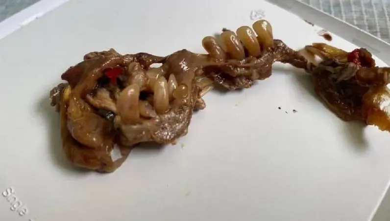 泰國妹吃沙拉咬到「似人類整排牙齒」崩潰狂吐　醫：可能是鯧魚