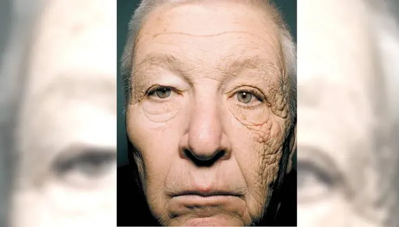太陽很毒！69歲卡車司機「只有左臉曬太陽」臉竟只有半邊快速老化