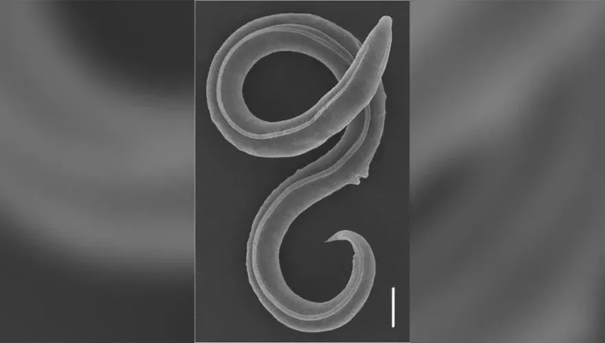 在西伯利亞永久凍土中冰凍4萬6千年　科學家成功復活新物種蠕蟲